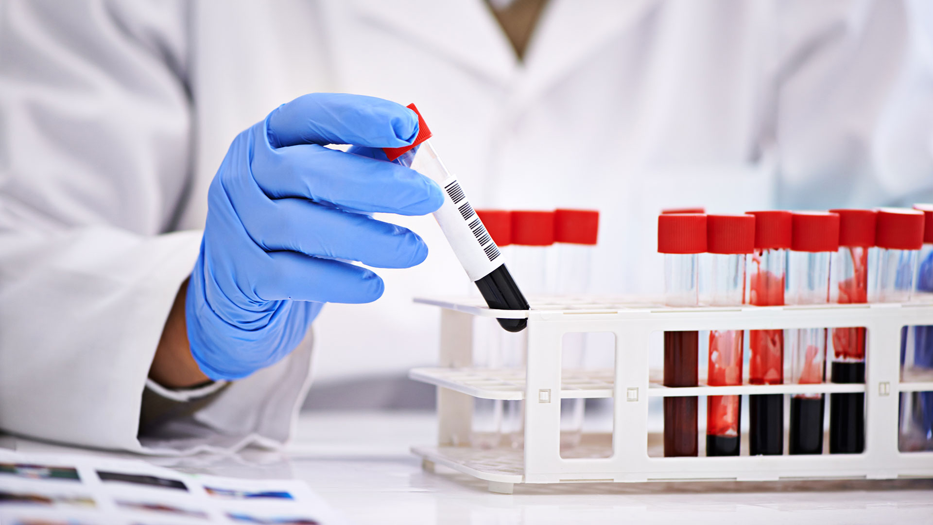 The Importance of Quality Control in Blood Testing